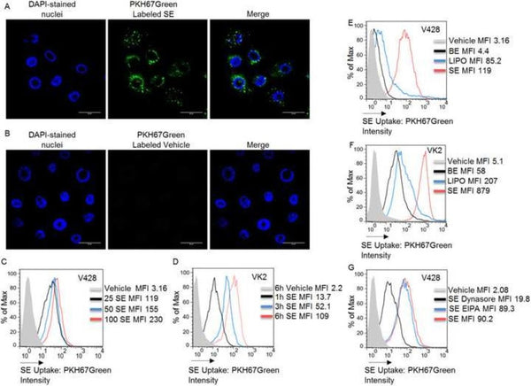Exosomes in human semen restrict HIV-1 transmission by vaginal cells and block intravaginal replication of LP-BM5 murine AIDS virus complex