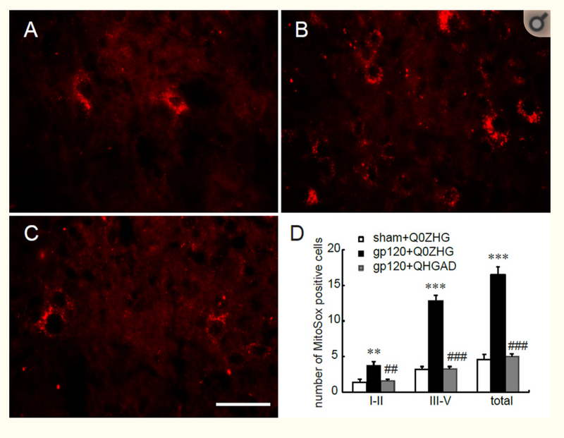 HSV vector-mediated GAD67 suppresses neuropathic pain induced by perineural HIV gp120 in rats through inhibition of ROS and Wnt5a.