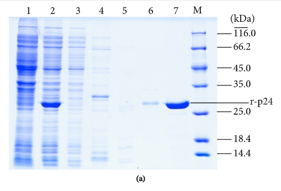 Development of Monoclonal Antibodies against HIV-1 p24 Protein and Its Application in Colloidal Gold Immunochromatographic Assay for HIV-1 Detection