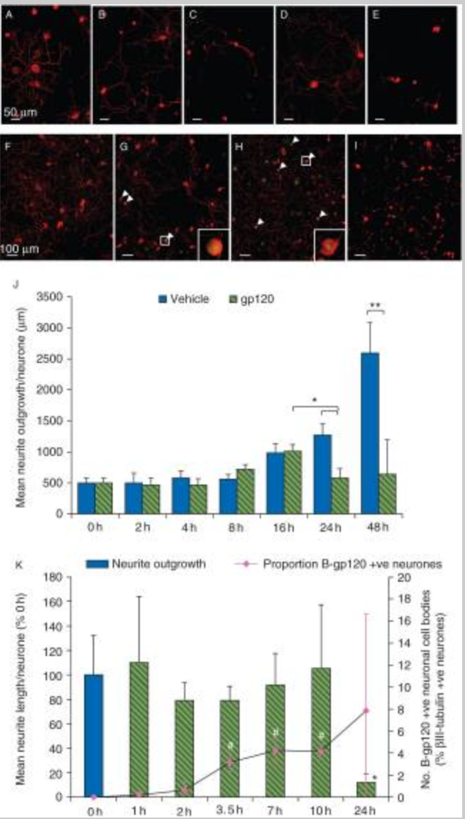 Macrophage-sensory neuronal interaction in HIV-1 gp120-induced neurotoxicity
