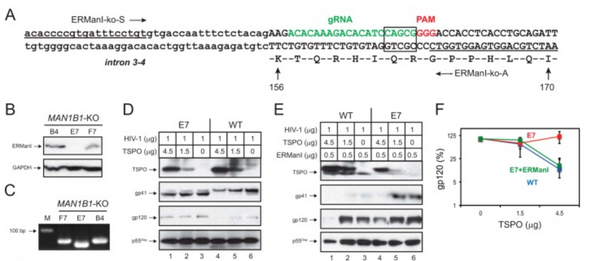 ERManI (Endoplasmic Reticulum Class I α-Mannosidase) Is Required for HIV-1 Envelope Glycoprotein Degradation via Endoplasmic Reticulum-associated Protein Degradation Pathway.