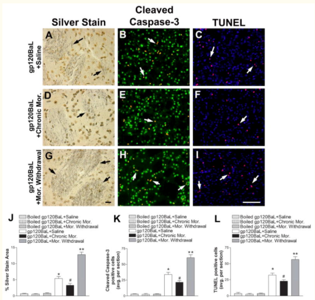 Pharmacological induction of CCL5 in vivo prevents gp120-mediated neuronal injury.