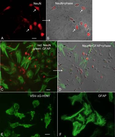 Chikungunya, Influenza, Nipah, and Semliki Forest Chimeric Viruses with Vesicular Stomatitis Virus: Actions in the Brain