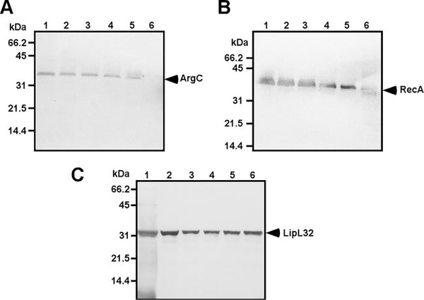 In Vivo-Expressed Proteins of Virulent Leptospira interrogans Serovar Autumnalis N2 Elicit Strong IgM Responses of Value in Conclusive Diagnosis