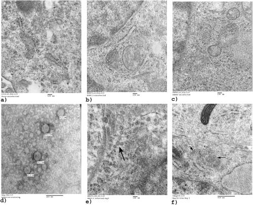 Zika virus replication and cytopathic effects in liver cells