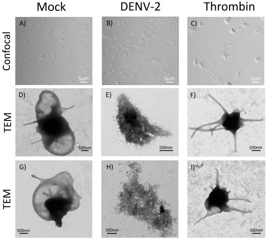 Dengue Virus Induces the Release of sCD40L and Changes in Levels of Membranal CD42b and CD40L Molecules in Human Platelets