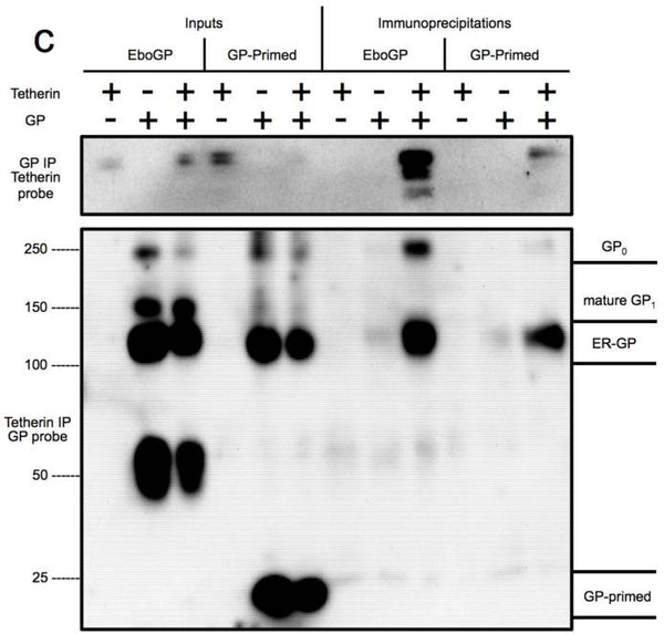 Requirements within the Ebola Viral Glycoprotein for Tetherin Antagonism