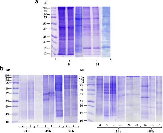 Onchocerca - infected cattle produce strong antibody responses to excretory-secretory proteins released from adult male Onchocerca ochengi worms