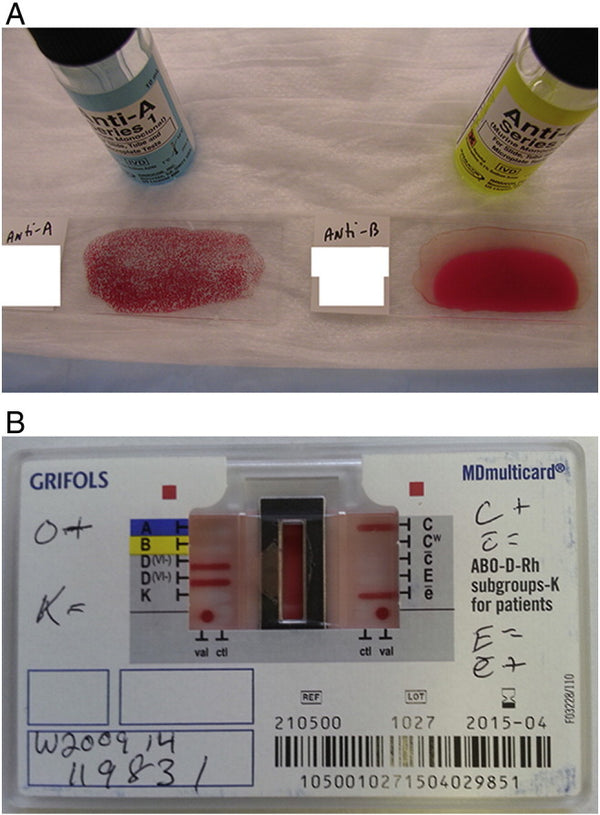 The Role of the Laboratory and Transfusion Service in the Management of Ebola Virus Disease