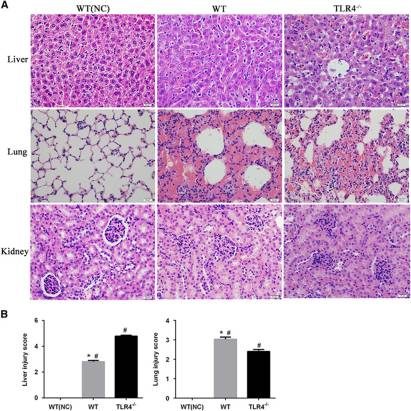 A new model of self-resolving leptospirosis in mice infected with a strain of Leptospira interrogans serovar Autumnalis harboring LPS signaling only through TLR4