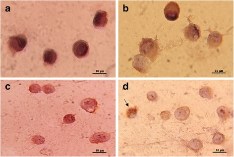 Vertical transmission of Indian Ocean Lineage of chikungunya virus in Aedes aegypti and Aedes albopictus mosquitoes