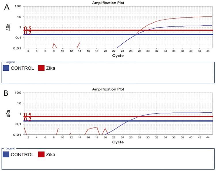 Epidemiological profile of Zika, Dengue and Chikungunya virus infections identified by medical and molecular evaluations in Rondonia, Brazil