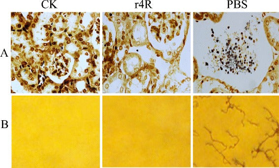 Chimeric epitope vaccine against Leptospira interrogans infection and induced specific immunity in guinea pigs