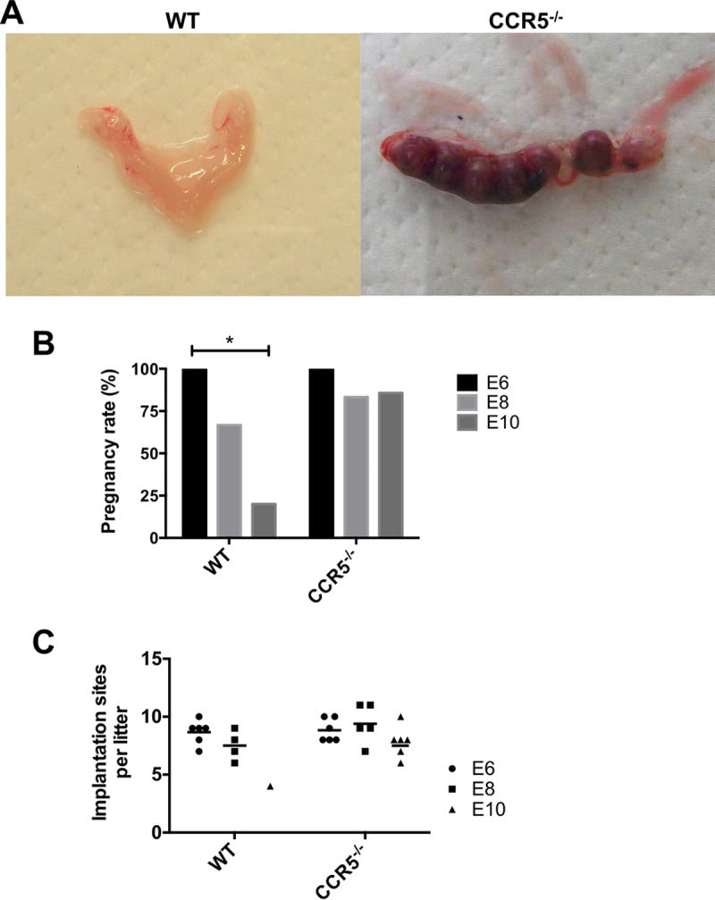 CCR5 Is Involved in Interruption of Pregnancy in Mice Infected with Toxoplasma gondii during Early Pregnancy